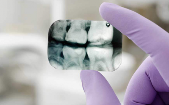 Портативная рентген диагностика