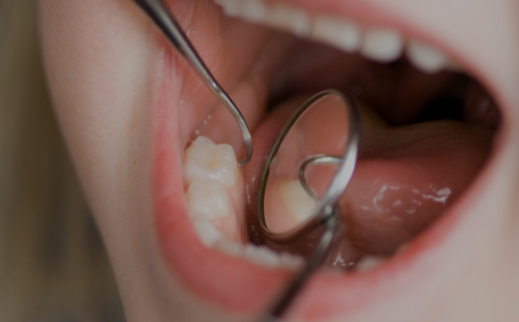 Хитрый и грозный враг зубов – кариес