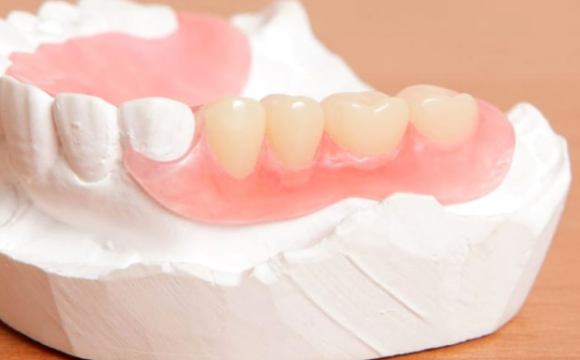 Зачем нужен временный протез «бабочка»