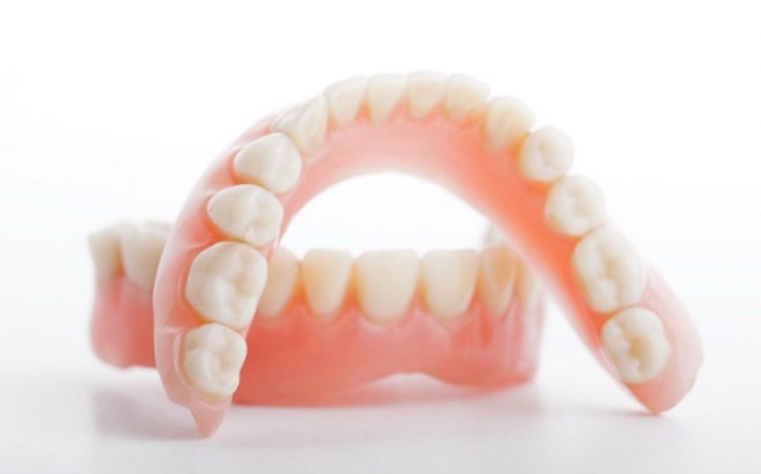 Зубной протез на присосках и его основные функции