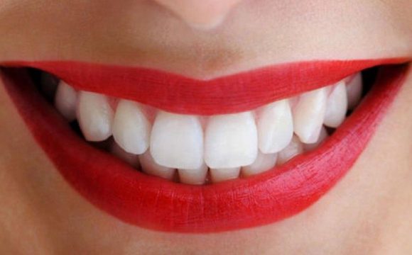 Что важно знать об отбеливании зубов