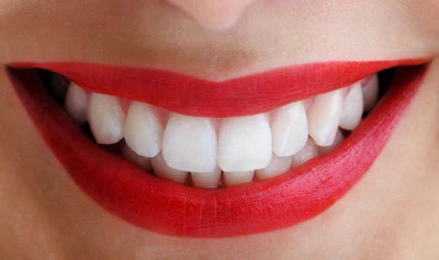 Что важно знать об отбеливании зубов