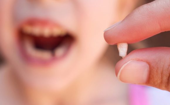 Уход за полостью рта после удаления зуба у ребенка Уход за полостью рта после удаления зуба у ребенка